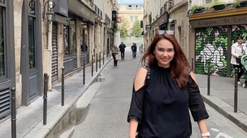 Curhat Feby Febiola yang Kini Botak karena Kemoterapi   